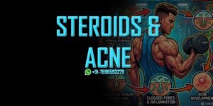 steroids cause acne