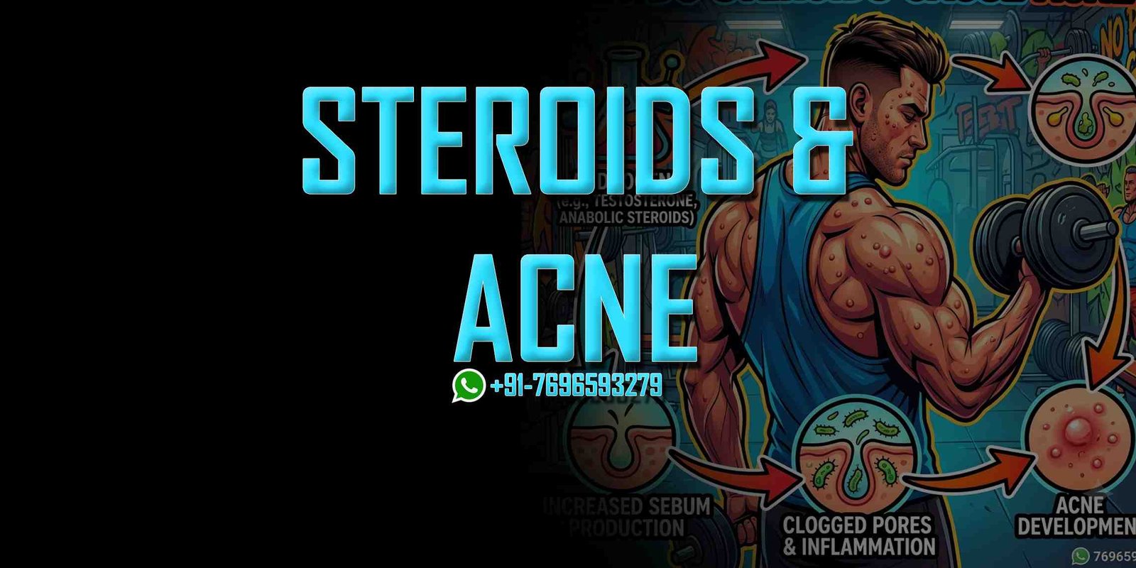 steroids cause acne