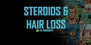 steroids cause hair loss